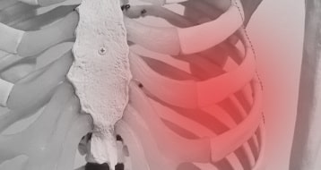 肋骨弓周辺の損傷診