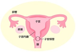 子宮外妊娠