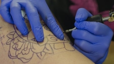 創傷感染症と異物感染症