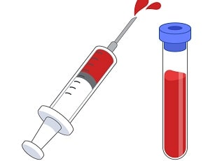 甲状腺の免疫異常を調べる血液検査