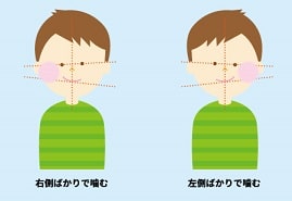 寿楽鍼灸整骨院　顎関節症7