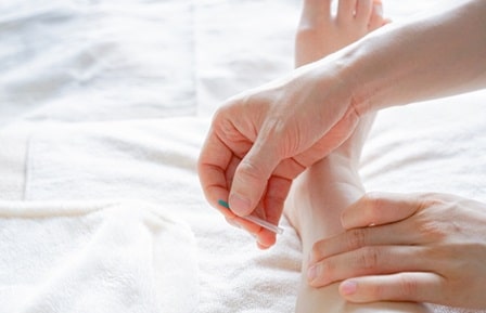 鍼灸施術の様子